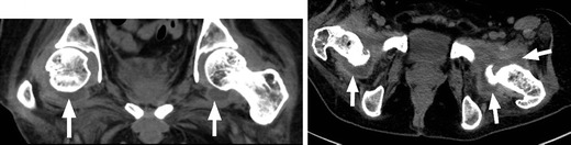 Fig. 23