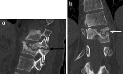 Fig. 14