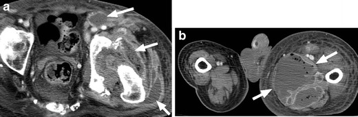 Fig. 21