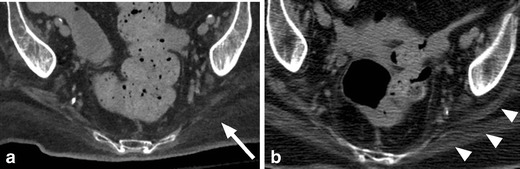 Fig. 16