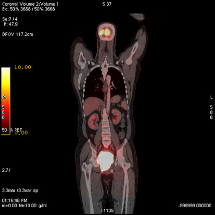 Fig. 10