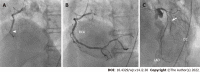 Figure 18
