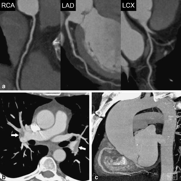 Fig. 4