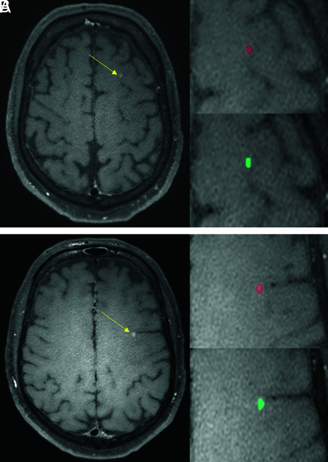 FIG 1.