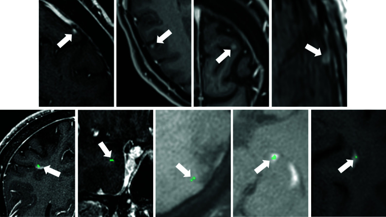 FIG 3.