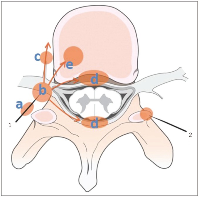 Fig. 14