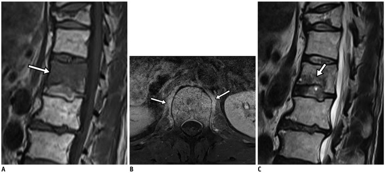 Fig. 13