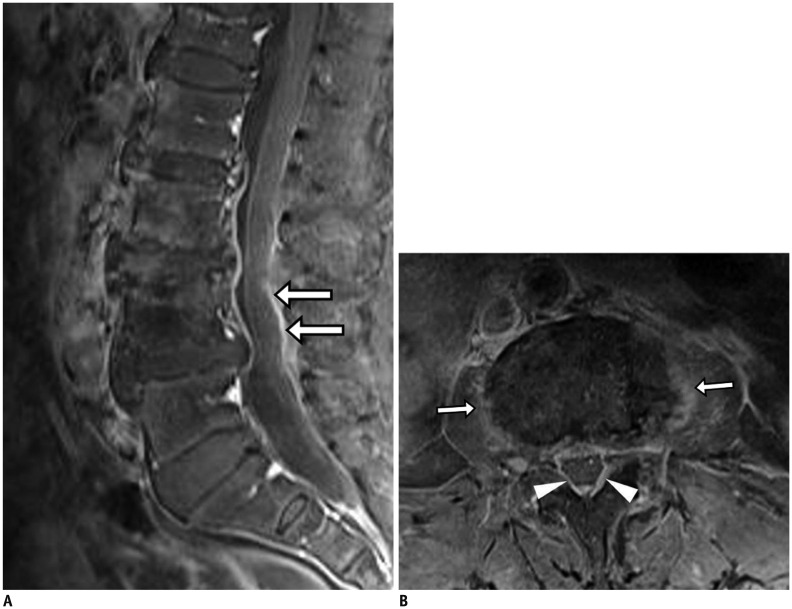 Fig. 11