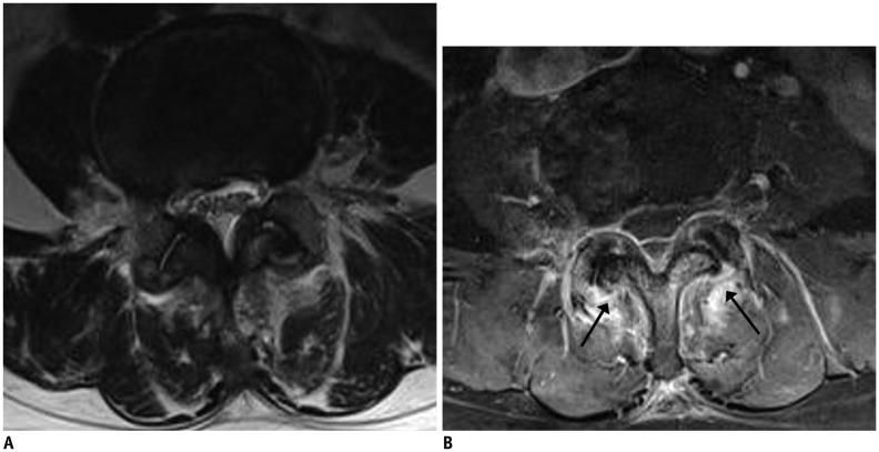 Fig. 15