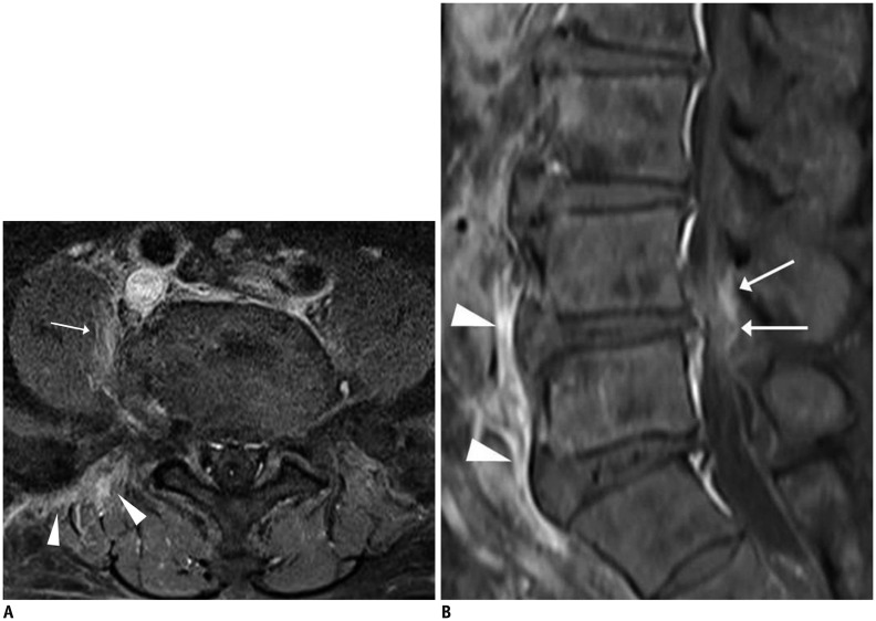 Fig. 16