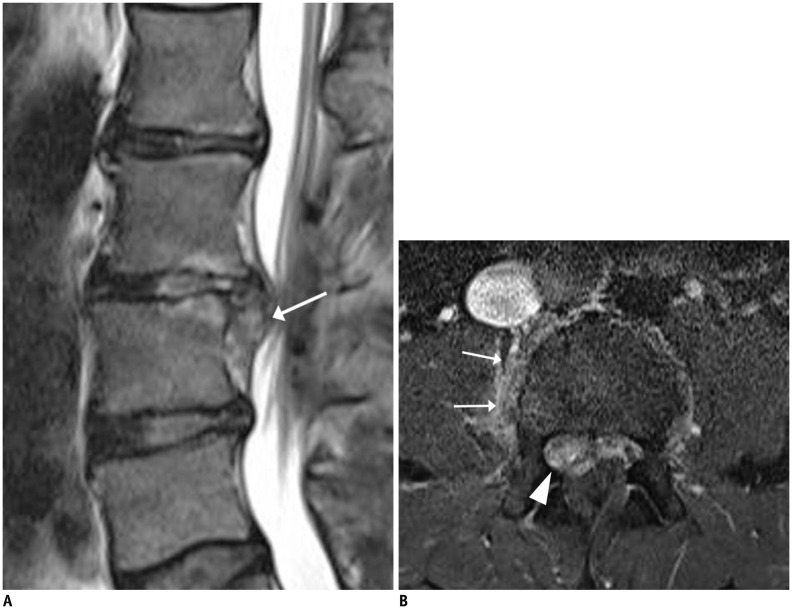 Fig. 12