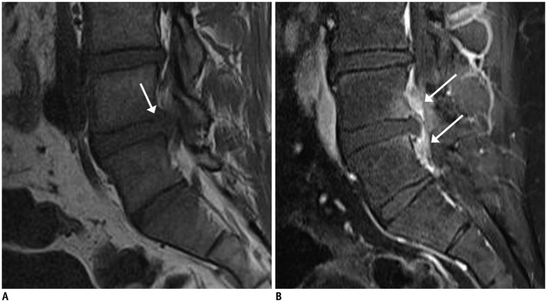 Fig. 17