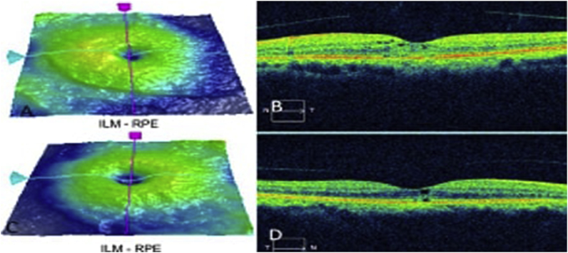 Fig. 4