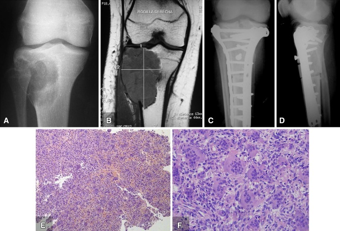 Fig. 1A–F