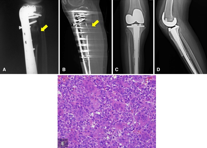 Fig. 2A–E