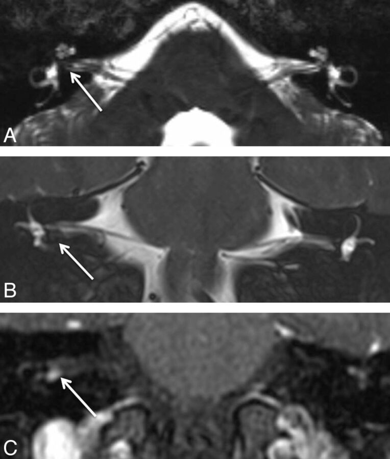 Fig 1.