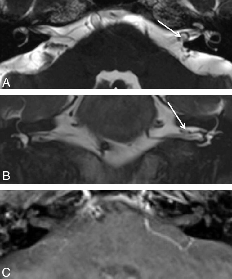 Fig 3.