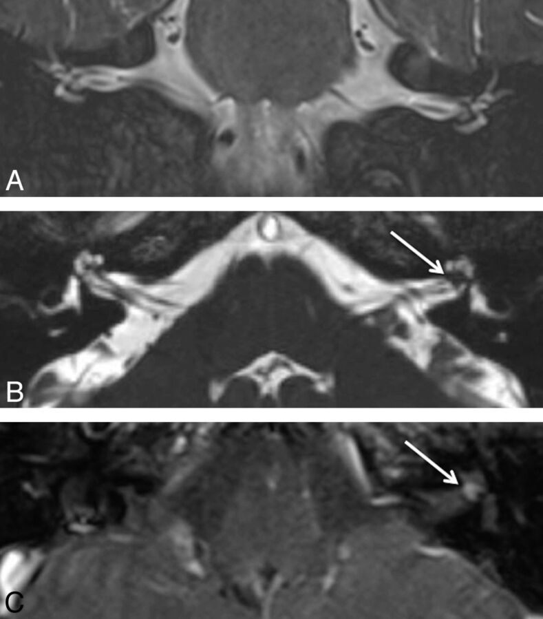 Fig 2.