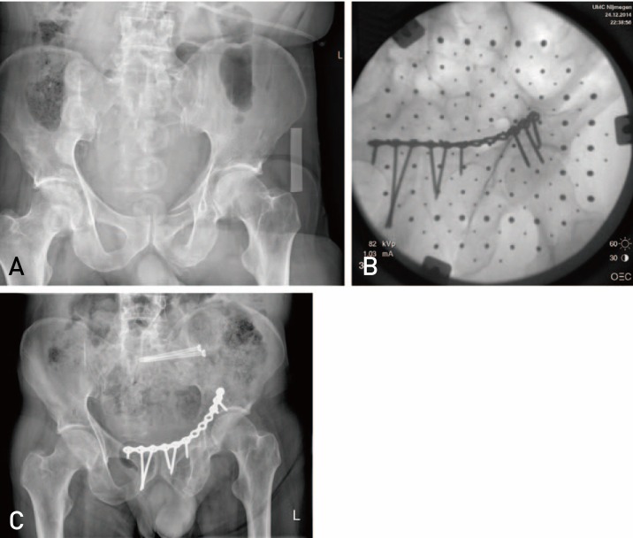 Fig. 3