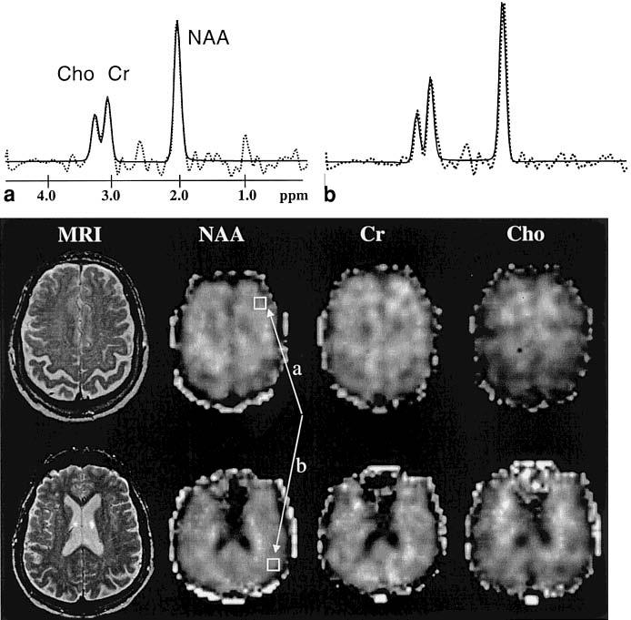 FIG. 1