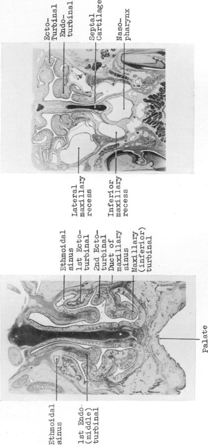 Fig. 14