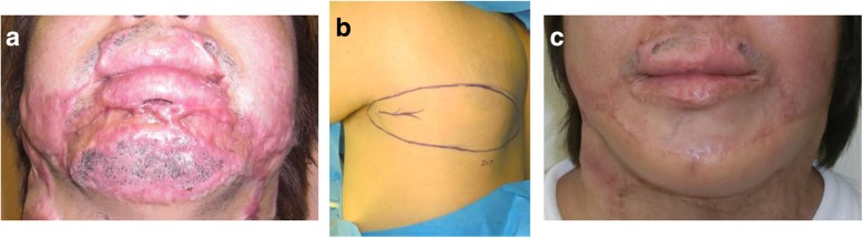 Fig. 10