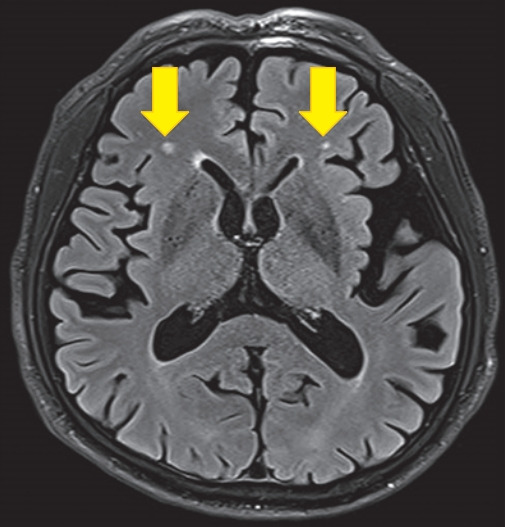 Figure. 1.