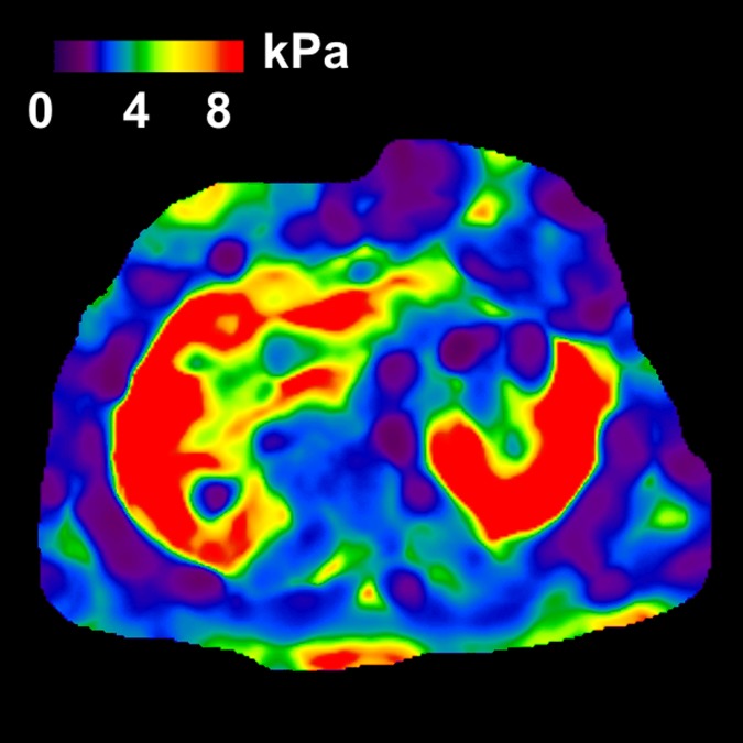 Figure 3b: