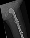 Fig. 14
