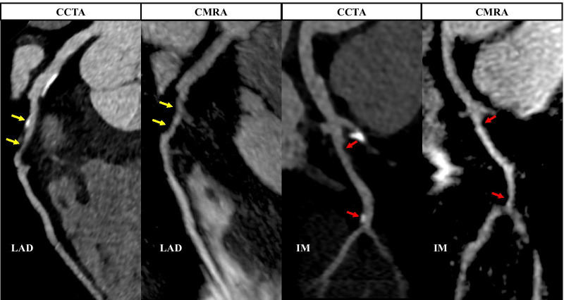 Fig. 10