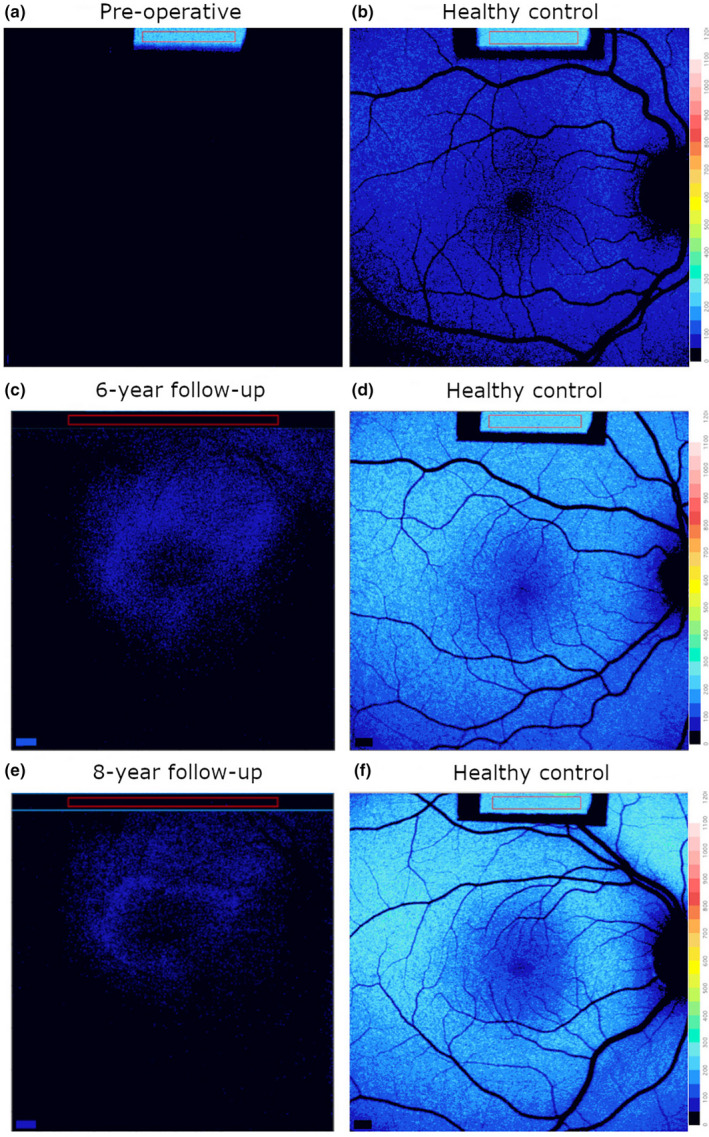 FIGURE 2