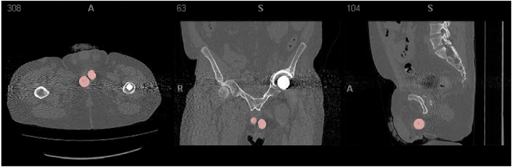 Fig. 3a