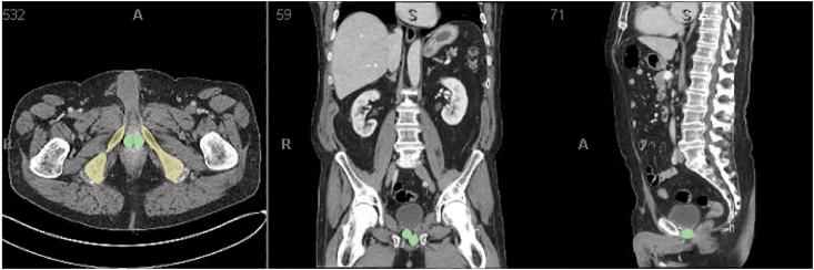 Fig. 3b