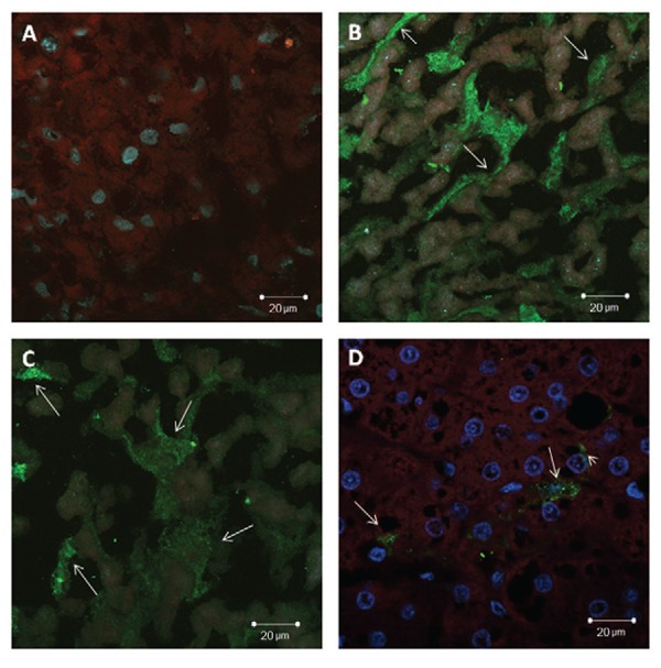 Hepatitis A antigen labelled with immunoglobulin Y (IgY) by indirect
immunofluorescence with confocal microscopy of the livers from cynomolgus monkeys
inoculated with hepatitis A virus (HAV). A: absence of fluorescence label cells
using a nonspecific IgY in HAV infected liver (control section); B, C: anti-HAV
IgY as a primary antibody binding specifically with viral antigens in cytoplasm of
sinusoidal lining cells (SLCs) (arrows); D: commercial anti-HAV IgG as primary
antibody binding specifically with viral antigens in hepatocytes (arrowhead) and
cytoplasm of SLCs (arrows).