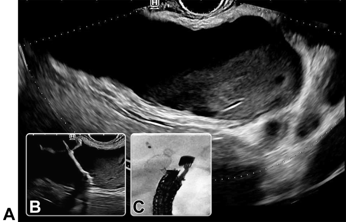 Figure 1