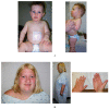 Fig. (1)
