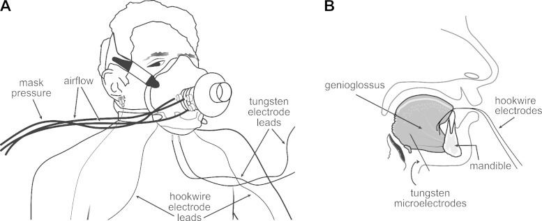 Fig. 1.