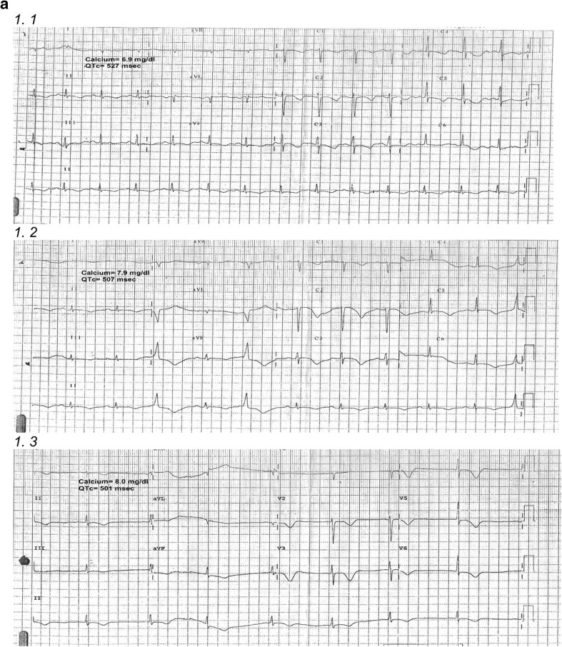 Fig. 1