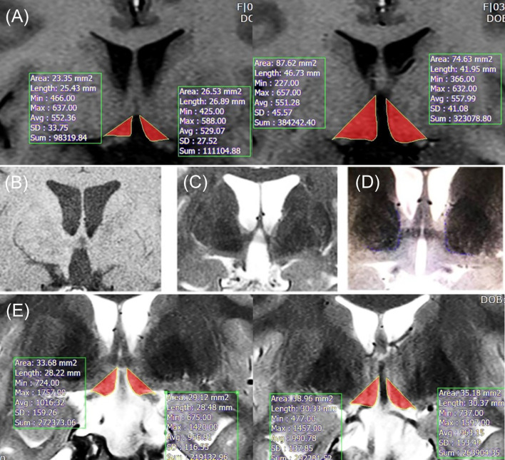 Figure 1