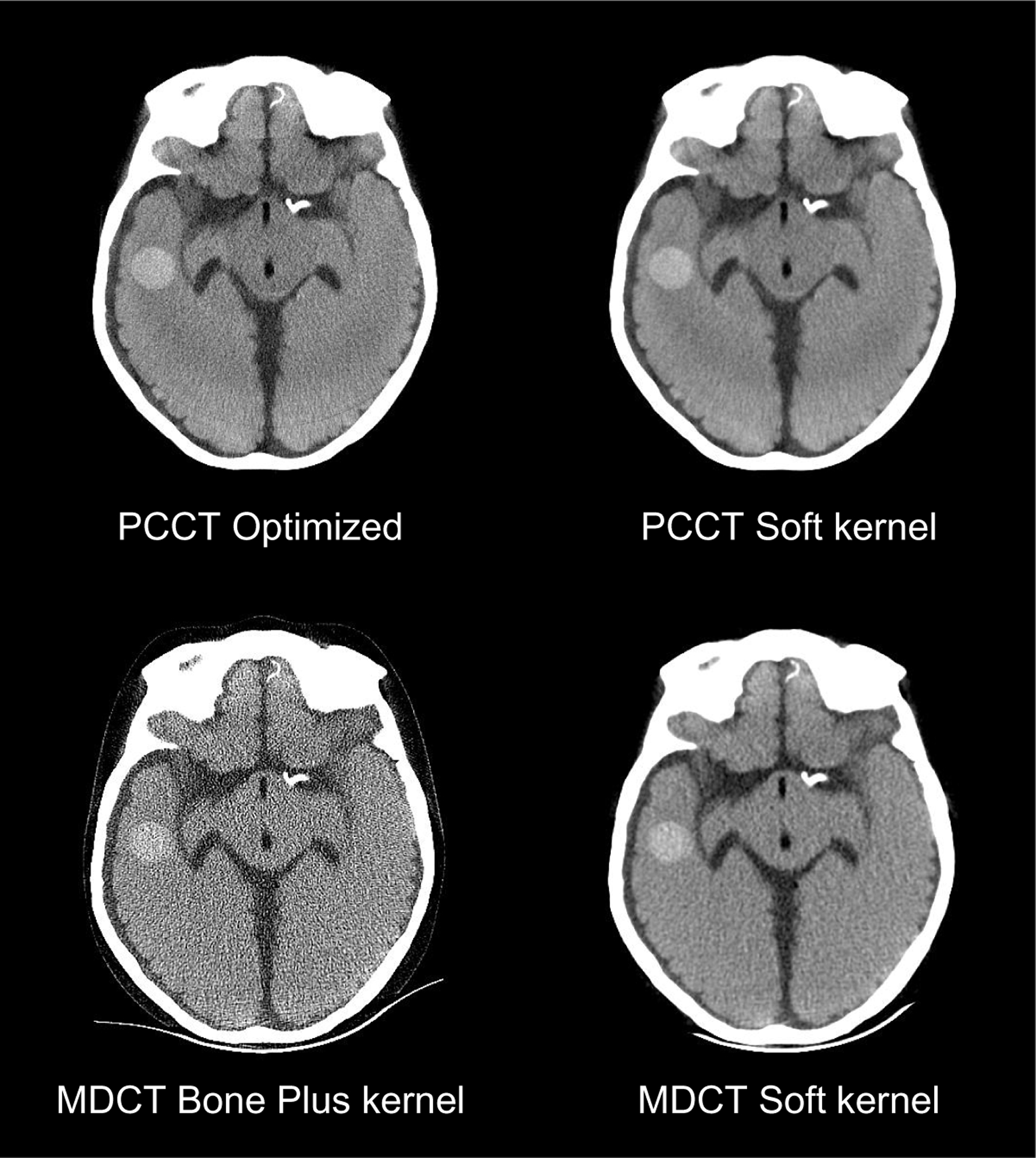 Figure 13.