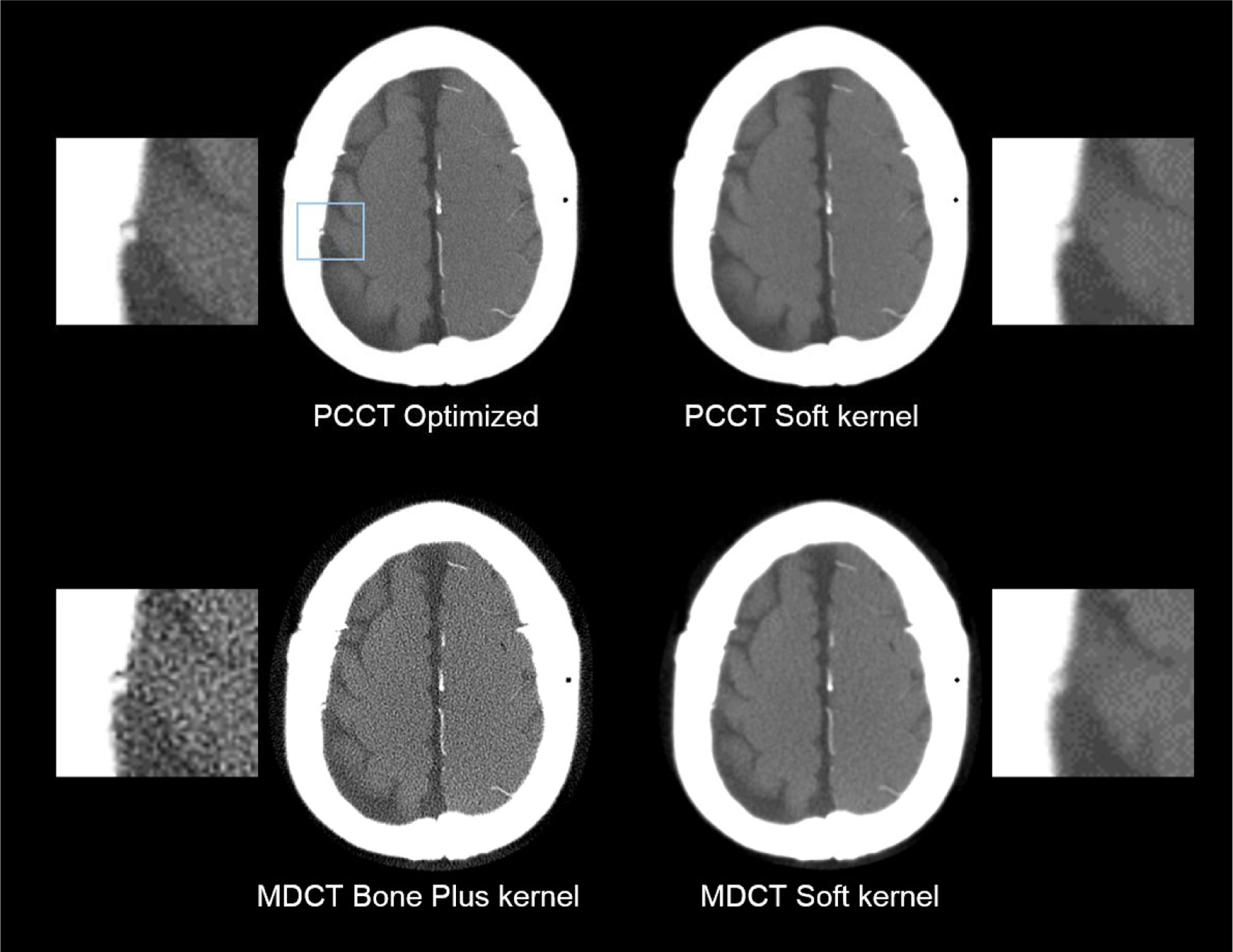 Figure 12.