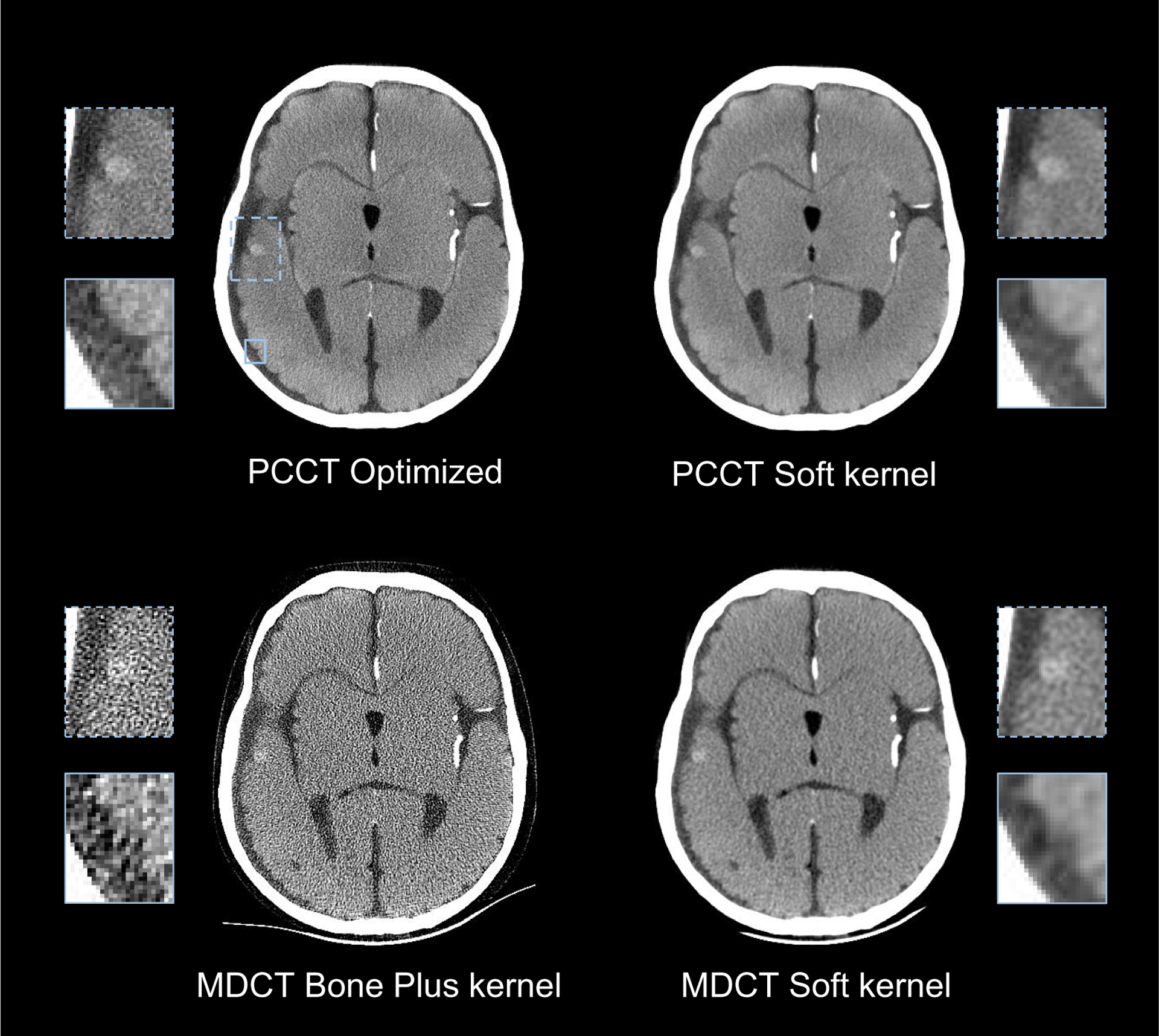 Figure 11.