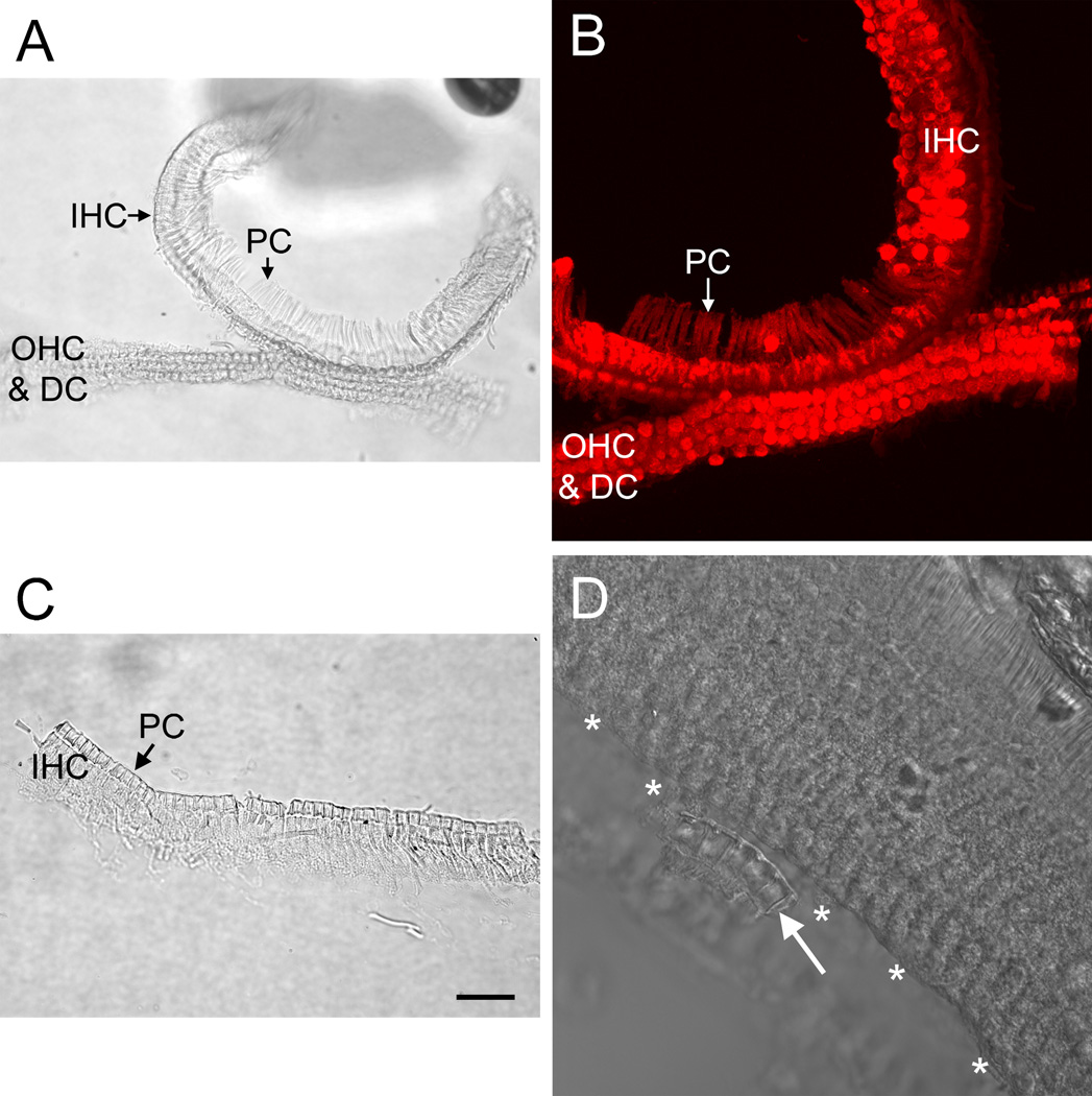 Figure 11