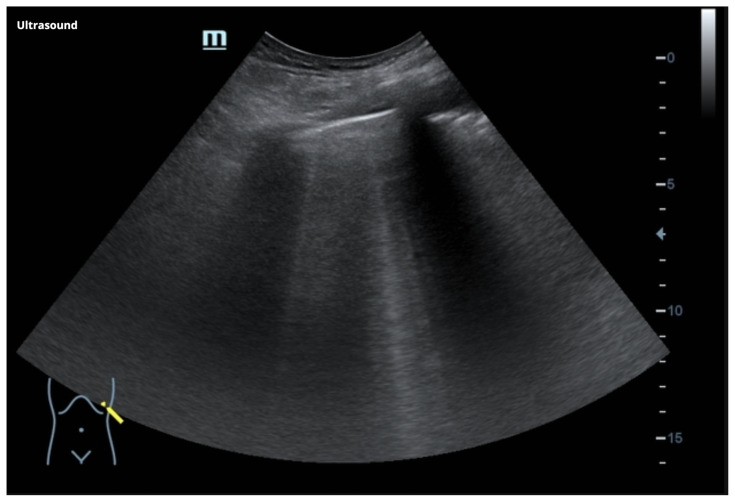 graphic file with name jetem-8-3-o1f5.jpg