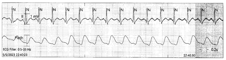 graphic file with name jetem-8-3-o1f2.jpg