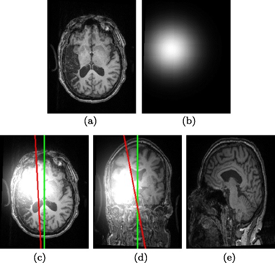 Fig. 10