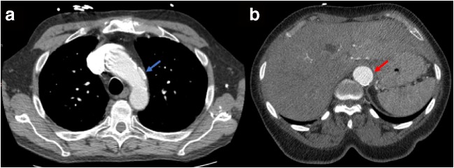 Fig. 5