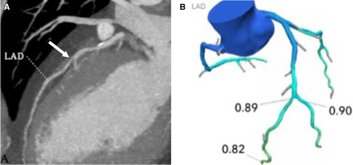 Fig. 11