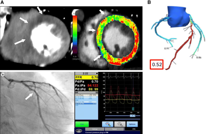 Fig. 13