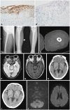 Fig. 1